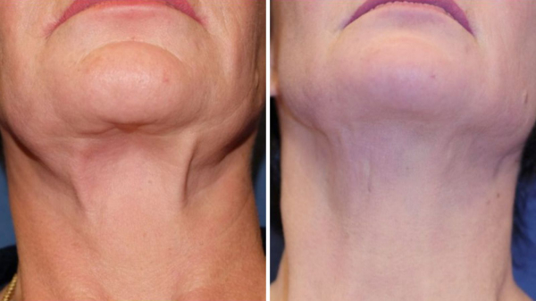 Image may contain Body Part Face Head Neck Person and Adult
